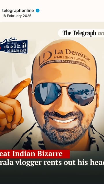 From a bald head to a viral idea… and finally, a head full of hair! 😎🔥

Shafeek Hashim turned his 