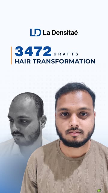 A transformation that feels natural.
A confidence that feels personal. 

For Mr. Aman Shikilkar, the