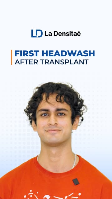 10 days after a hair transplant… can you even tell? 
For actor & model Kushagra, Day 10 marks an imp