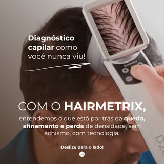 Diagnóstico capilar como você nunca viu.

Com o HairMetrix, deixamos de lado o achismo e passamos a 
