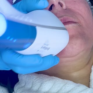 Sunspots don’t stand a chance 🔆 Clear & Brilliant® gently resurfaces your skin to fade pigmentation