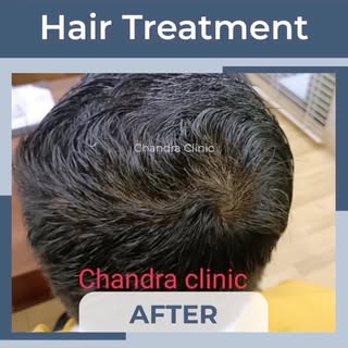 Did you see how quick the transition was? Well, you can have such transformation in your life too. Y