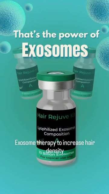 Exosome therapy to increase hair density