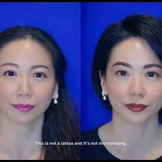 Dr. Williams performs eyebrow restoration on both men and women.#eyebrows #eyes #eyebrowstudio #eyeb