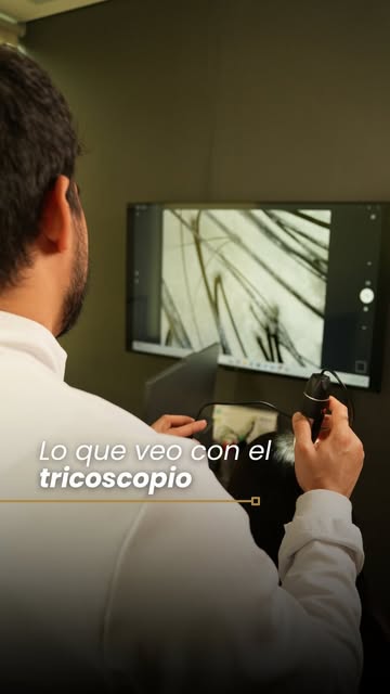 Lo que realmente pasa en tu cuero cabelludo en tiempo real 🤯🔬
Muchos se miran al espejo y solo ven