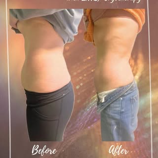 Sculpt. Define. Refine 🪷

Target stubborn areas with our non invasive body optimization treatments.