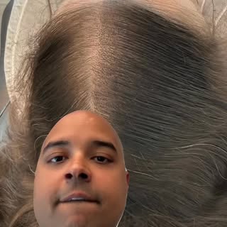 #FemaleHairLoss #ScalpMicropigmentation #SMP #HairLossSolutions. “Thinning hair doesn’t define you. 
