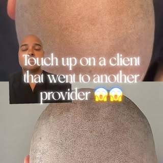 Before and after touch up on a client that went to another provider last year 🔥 #FemaleHairLoss #Sc