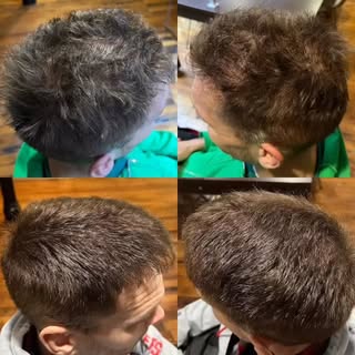 Dont always have to shave it down…..IF………..you have enough to do a density fill. 
#scalpmicropigment