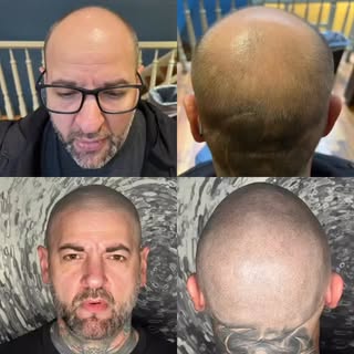 Nother collage for ya.  Get ya poke on with Scalp Hq…..