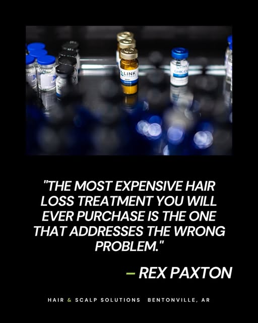 There is an overwhelming amount of information available about hair loss treatments, and most of it 