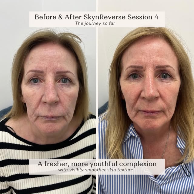 “What are you doing?! You’re ageing backwards!”

That’s what someone recently said to this client af