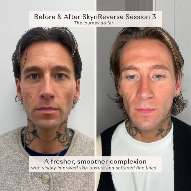 Three sessions can make a pretty noticeable difference.

These photographs show the progress we’ve a