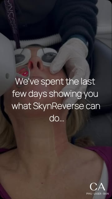 You’ve seen the results we’ve been sharing over the last few days… now imagine what your own SkynRev