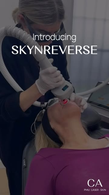 What if one treatment could transform your skin — from face to body? ✨
Meet SKYNREVERSE — a revoluti