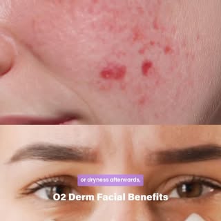 Breathe new life into your skin with the O2 Derm Facial for deep hydration, radiant glow, and a refr