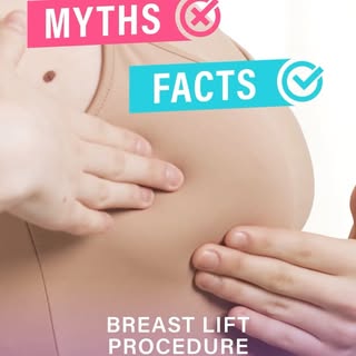 Here are some common myths and the real facts. About Breast lift procedure.
#BreastLift #MythVsFact 