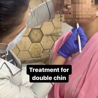 Treatment for double chin…fat loss injection…
Excellent results in 2-3sessions….result in 15days 

F