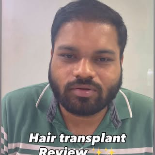 Hair transplant Reveiw 👏👏
For more details call our expert doctor on 8828475882