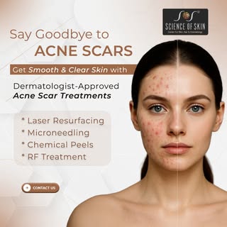Say goodbye to acne scars and hello to smooth, clear skin! 🌟
Our advanced acne scar treatments help