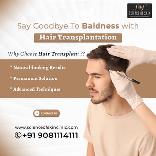 Say Goodbye to Baldness with Hair Transplantation @scienceofskinclinics