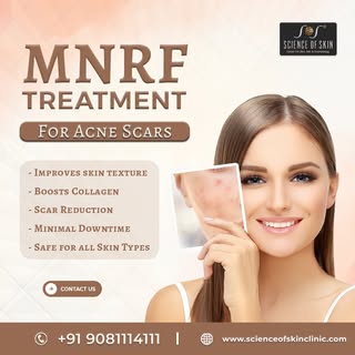 ✨ Reclaim your skin’s glow with MNRF treatments at SOS Clinic!
This advanced procedure combines micr
