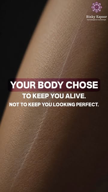 Before birth, there is a stage when human skin can heal without leaving a scar.

Then, something cha