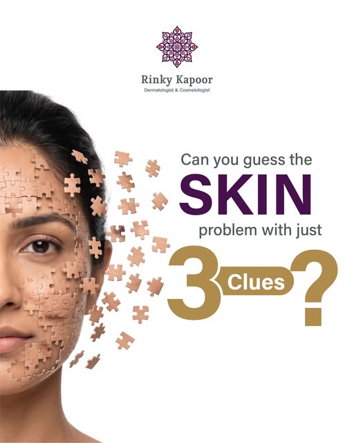 You may be fooling yourself into thinking it’s acne.

Because not every breakout that looks like acn