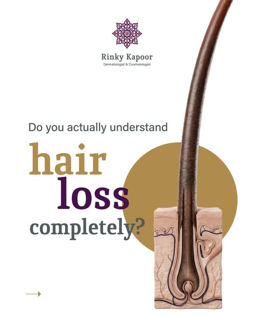 What actually happens to a hair follicle before it becomes what we call "hair loss"?

It doesn't dis