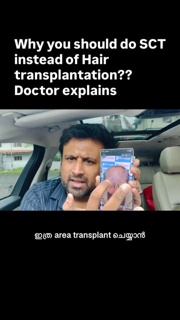 Why should you take stem cell activation instead of hair transplantation #dlapp #hairgrowth #hairlos