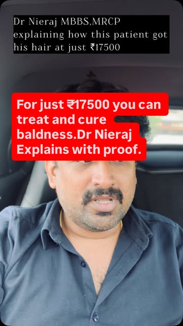 കഷണ്ടിക്കും പരിഹാരം വെറും ₹17500 രൂപയ്ക്ക് #dlapp #hairgrowth #hairlosstreatment #hairtransformation