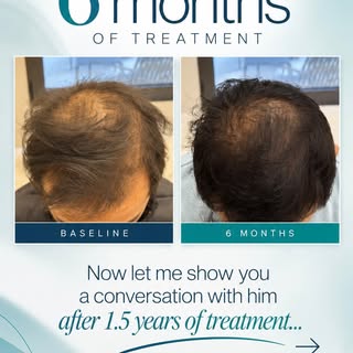 It was so special and rewarding to have this conversation with my patient after 1.5 years of treatme