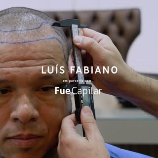 🌟 Transforme sua autoestima com o melhor em transplante capilar! 🌟

Você sabia que o ex-jogador da