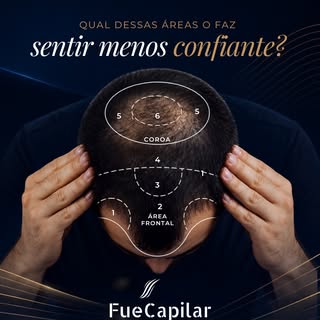 Seu cabelo pode voltar a fazer parte da sua identidade.

A queda de cabelo não afeta apenas os fios.