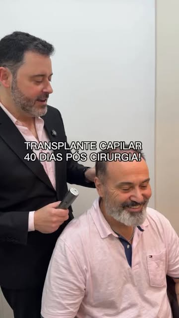 40 DIAS DA CIRURGIA DE TRANSPLANTE CAPILAR! 💁👦
@fue.capilar 
@drdiogoanderle 

‼️ Por aqui um suce