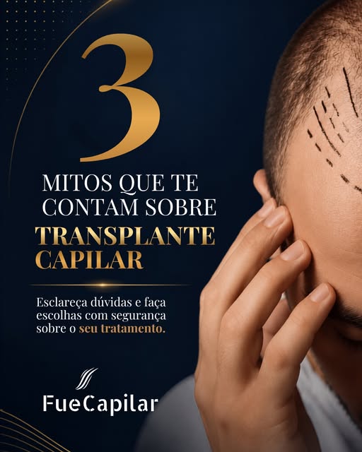 Transplante capilar: informação também faz parte da transformação.

Ainda existem muitos mitos sobre