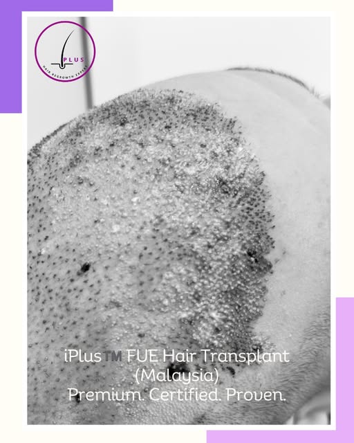 💟 𝕚ℙ𝕝𝕦𝕤™️ 𝔽𝕌𝔼 ℍ𝕒𝕚𝕣 𝕋𝕣𝕒𝕟𝕤𝕡𝕝𝕒𝕟𝕥 𝕄𝕒𝕝𝕒𝕪𝕤𝕚𝕒 | 𝕂𝕦𝕒𝕝𝕒 𝕃𝕦𝕞𝕡𝕦𝕣 | 𝕊ℙ�