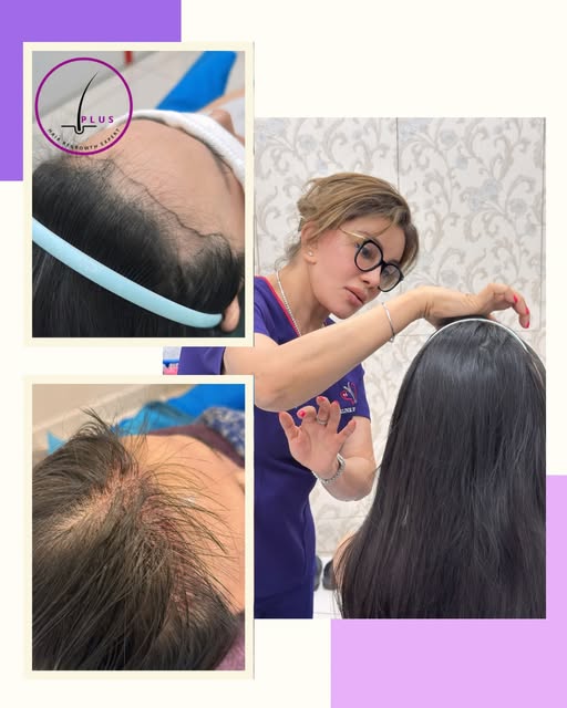 💟 𝕚ℙ𝕝𝕦𝕤™️ 𝔽𝕌𝔼 ℍ𝕒𝕚𝕣 𝕋𝕣𝕒𝕟𝕤𝕡𝕝𝕒𝕟𝕥 𝕄𝕒𝕝𝕒𝕪𝕤𝕚𝕒 | 𝕂𝕦𝕒𝕝𝕒 𝕃𝕦𝕞𝕡𝕦𝕣 | 𝕊ℙ�
