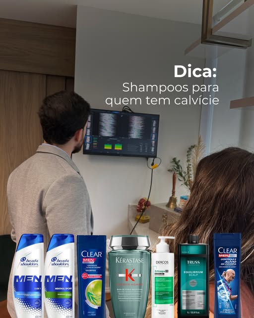 Shampoo para calvície funciona? 

Depende do que você espera dele.

Ele não vai fazer o cabelo nasce