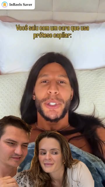 Não passou na Fábrica de Cabeludos da Clinica Audra deu nisso né 🤭
#calvicie #transplantecapilarfue