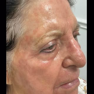 UltraClear laser treatments deliver results you can see and feel — with minimal downtime. Watch to s