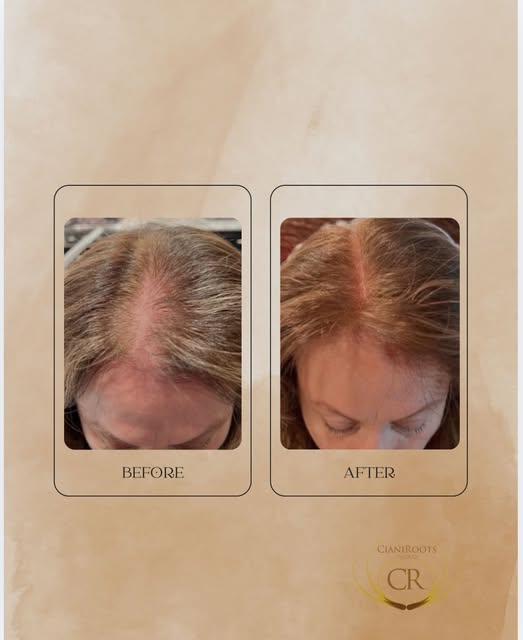 This transformation speaks for itself.
Our patient underwent a series of 6 advanced treatments combi