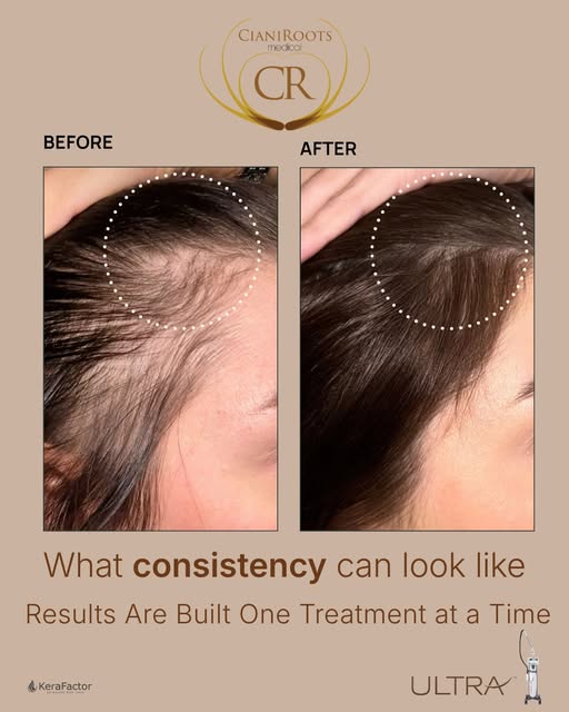 Consistency Matters. Results Are Built One Treatment at a Time.

One of the most important things I 