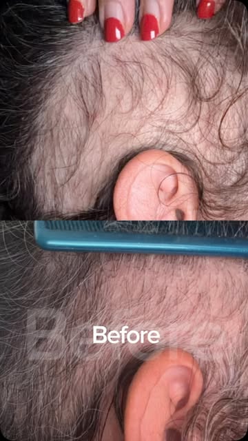 ✨ THIS ONE IS SPECIAL. ✨
This was a challenging case, but with a tailored approach designed specific