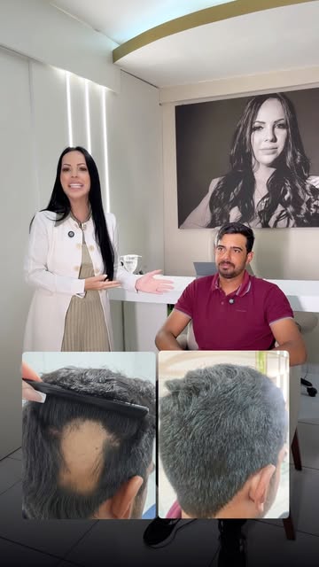 ✨ Evolução da alopecia areata!

Esse é mais um caso que mostra a importância de acompanhar a condiçã