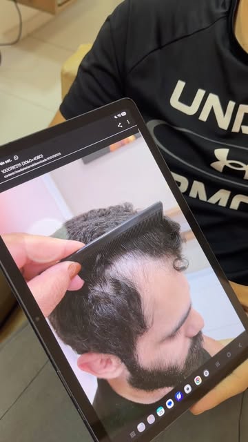 Olha essa evolução capilar! ✨ Ainda estamos no início do tratamento, mas já conseguimos perceber nov