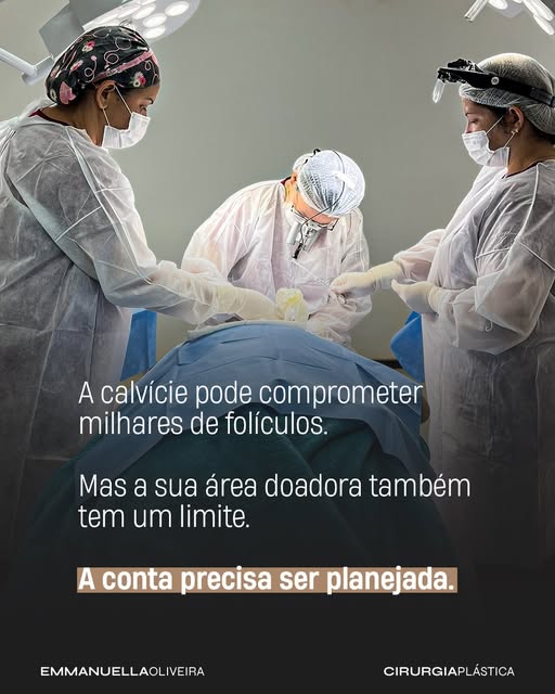 Muita gente acredita que o transplante capilar é apenas uma questão de colocar o maior número possív