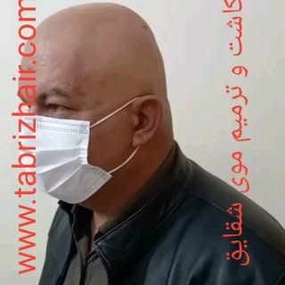 کاشت و ترمیم موی شقایق در تبریز 
آماده ارائه خدمات کاشت و ترمیم مو(پروتز مو ) با جدید ترین متدد روز 