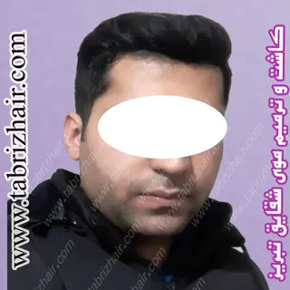 کاشت و ترمیم موی شقایق در تبریز 
آماده ارائه خدمات کاشت و ترمیم مو(پروتز مو )با جدیدترین متدد روز دن