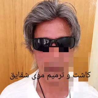 #پروتز_مو 
#ترمیم_مو 
#ترمیم_مو_آقایان 
 #تبریز
#ترمیم_مو_بانوان